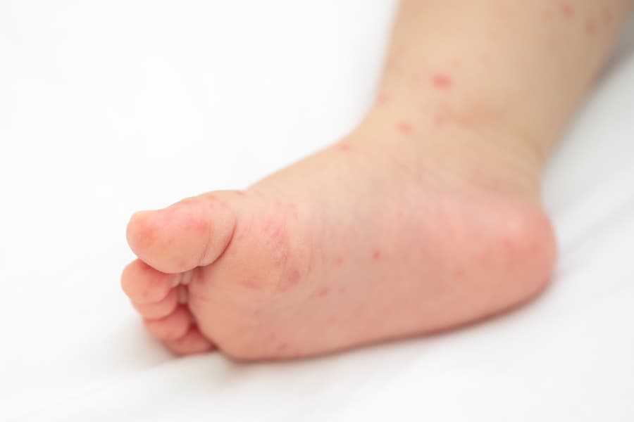 とうがね中央糖尿病腎クリニックのフットケア外来